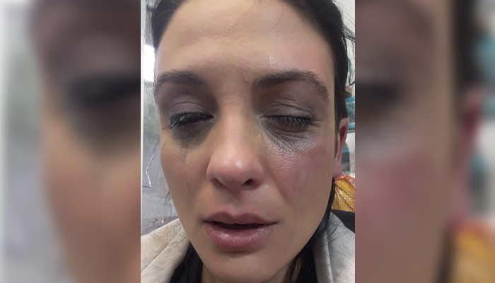 Актрисата от театър Зад канала сподели, че е станала жертва