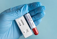 Делът на положителните резултати в страната е 9 07 процентаВ Русенско