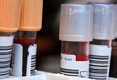 Според учените кръвната група на човек оказва влияние върху продължителността