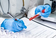 Мобилен екип на РЗИ ще прави безплатни бързи тестове за