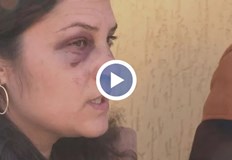 При катастрофата са ранени жена и детето ѝ Кола с