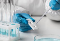 Няма починали през денонощиетоВ Русенска област новозаразените с коронавирус са