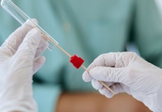 В страната 372 пациенти са в болница като 37 от