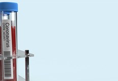 Новозаразените с коронавирус в Русе са 11 169 са новите