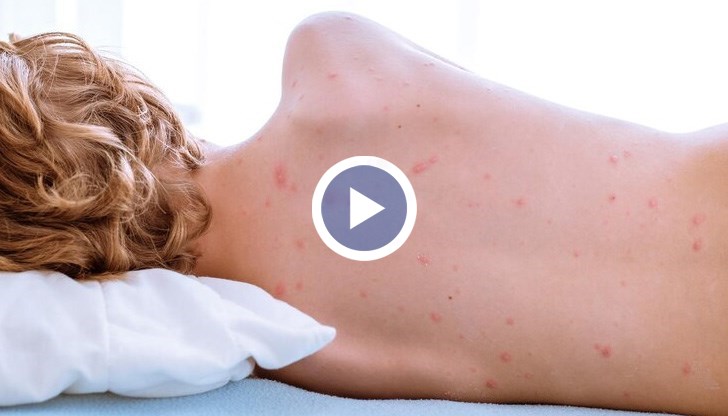 Само за последната седмица инфектираните са над 1000