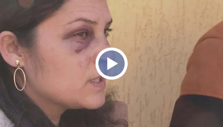 При катастрофата са ранени жена и детето ѝ