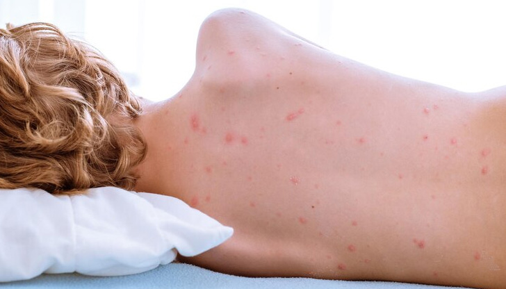 Само за последната седмица инфектираните са над 1000Рязък скок в