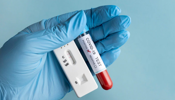 Делът на положителните резултати в страната е 9,07 процентаВ Русенско