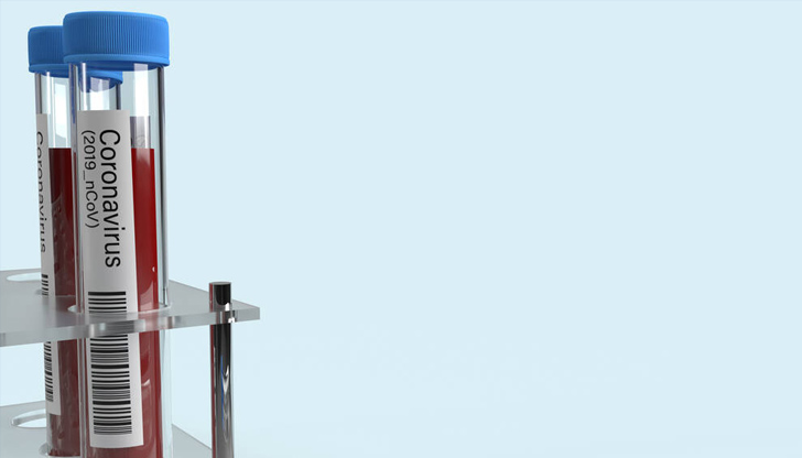 Новозаразените с коронавирус в Русе са 11 169 са новите