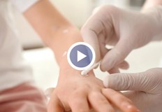 Лекарите съветват да не се използват антибиотициБум на варицела у