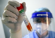 В България вече са установени три случая на въпросната коинфекция