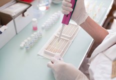 Най често синдромът VEXAS поразява смъртоносно мъжеЛекарите и изследователите са озадачени