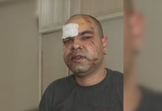 Побоят над Кирил Петров стана в петък вечерта пред дома