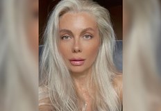 Блондинката претърпя операция на минискусаВенета Райкова се прибра вкъщи след