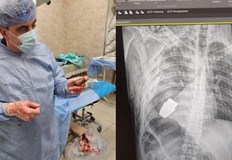 В операционната са присъствали и двама сапьориВоенни лекари в Украйна