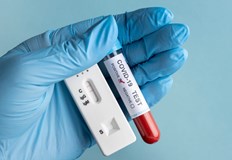 91 са новите случаи за изминалото денонощие у нас91 са