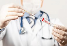 Положителни са близо 6 2 от пробите301 са новите случаи на