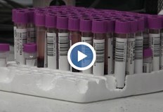 Най засегнати са децата до 4 години както и тези от