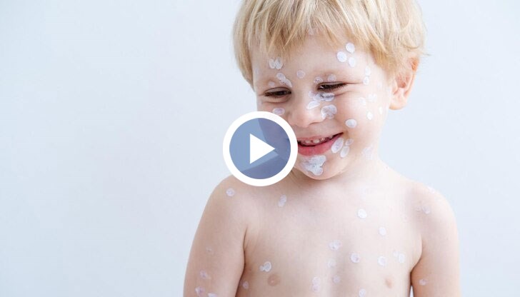 Случаите в първата седмица на тази година са 5 пъти повече спрямо същия период на 2022 година