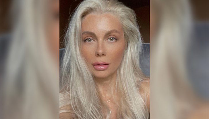 Блондинката претърпя операция на минискуса