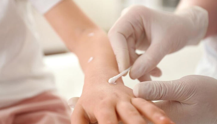 Лекарите съветват да не се използват антибиотициБум на варицела у