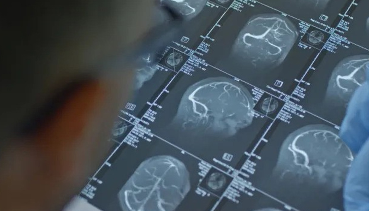 И двамата живеят от години с неврологичното заболяване, за което