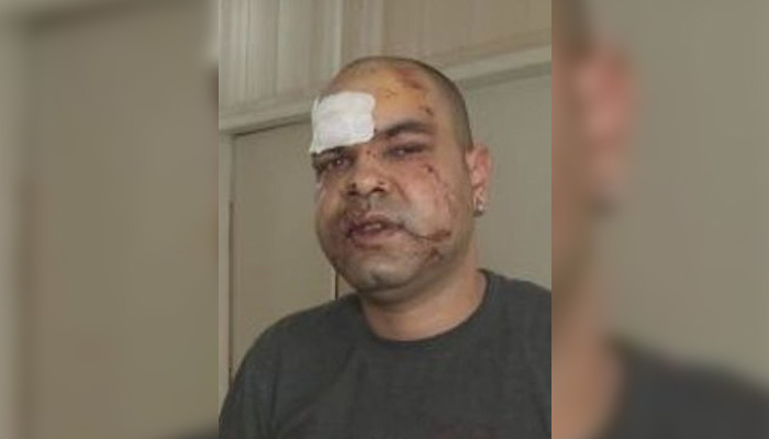 Побоят над Кирил Петров стана в петък вечерта пред дома