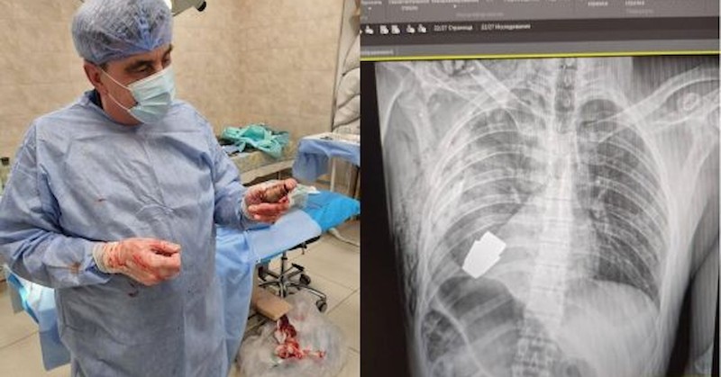 В операционната са присъствали и двама сапьориВоенни лекари в Украйна