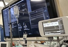 В УМБАЛ Проф д р Александър Чирков успешно имплантират СRТ D пейсмейкърШестима