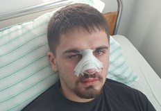 Спират да го бият чак когато си гълта езика и