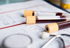 Две трети от всички случаи на рак при възрастни могат