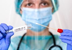 Няма починали с коронавирусна инфекция16 са новите случаи на коронавирус