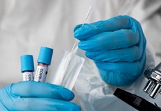 Направени са 819 теста в странатаВ Русенско има само един