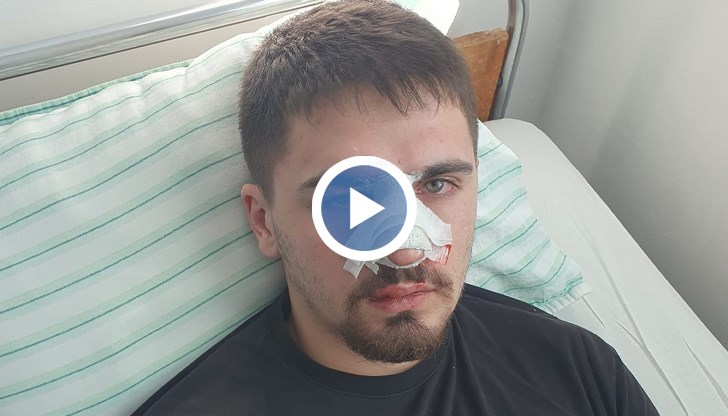 Синът ми е оставен почти безжизнен, разказва Костадин Недялков, баща на пострадалото момче