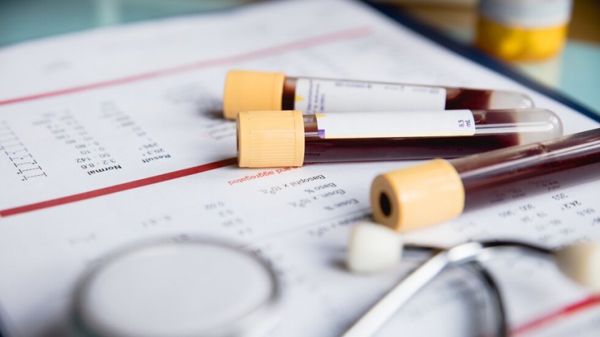 Две трети от всички случаи на рак при възрастни могат