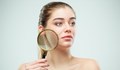 Природни методи помагат за трайно премахване на нежелани косми по лицето