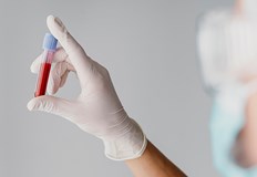 Учени заявиха кой е нормалният диапазон за нивата на кръвната