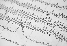 По първоначални данни няма пострадалиЗемен трус с магнитуд 4 6 е