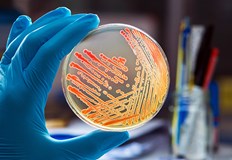 Той се е заразил след като се е измил с