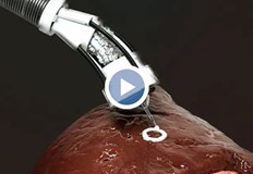 Сега биопечат се използва основно за изследване и разработване на