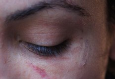 Актрисата публикува непоказвани снимки със следи от насилие за да