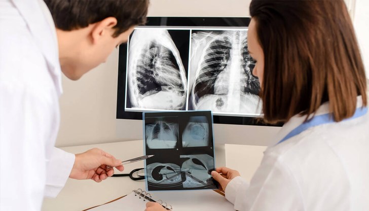 В област Русе заболеваемостта от туберкулоза е 11,8 на 100 хиляди при средна стойност за страната от 9,7 В област Русе заболеваемостта от туберкулоза е 11,8 на 100 хиляди при средна стойност за страната от 9,7