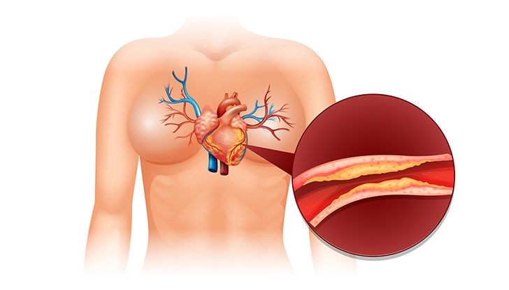 Холестеролът е жизненоважен за образуването на клетъчните мембрани Холестеролът е жизненоважен за образуването на клетъчните мембрани
