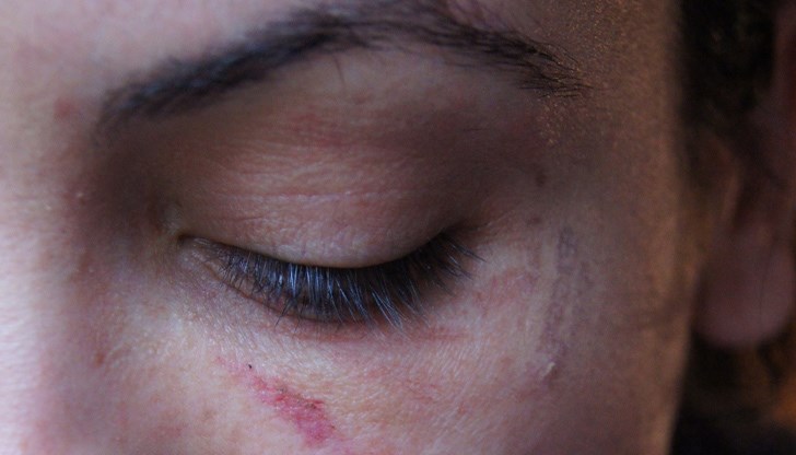 Актрисата публикува непоказвани снимки със следи от насилие, за да се защити от нападките Актрисата публикува непоказвани снимки със следи от насилие, за да се защити от нападките