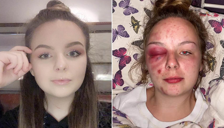 Британка твърди, че е била дрогирана, изнасилена и принудена да