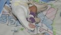 Болница в Благоевград покрива случай на бебе, изписано със счупен крак