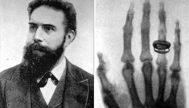 Открил ги е германският физик Вилхелм Рьонтген, а първата рентгенова снимка е на ръката на съпругата му