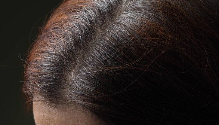 Преждевременното побеляване на косата може да е сигнал за здравословен проблем