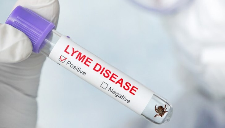 В Хасково регистрираха първия случай на лаймска болест В Хасково регистрираха първия случай на лаймска болест