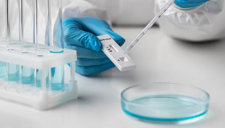 Делът на положителните резултати в страната е около 7 процента Делът на положителните резултати в страната е около 7 процента